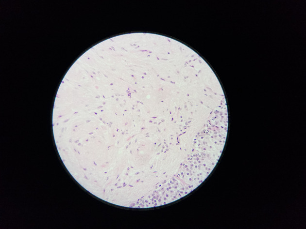 Pituitary Gland Slides - Pituitary Gland 009 400X